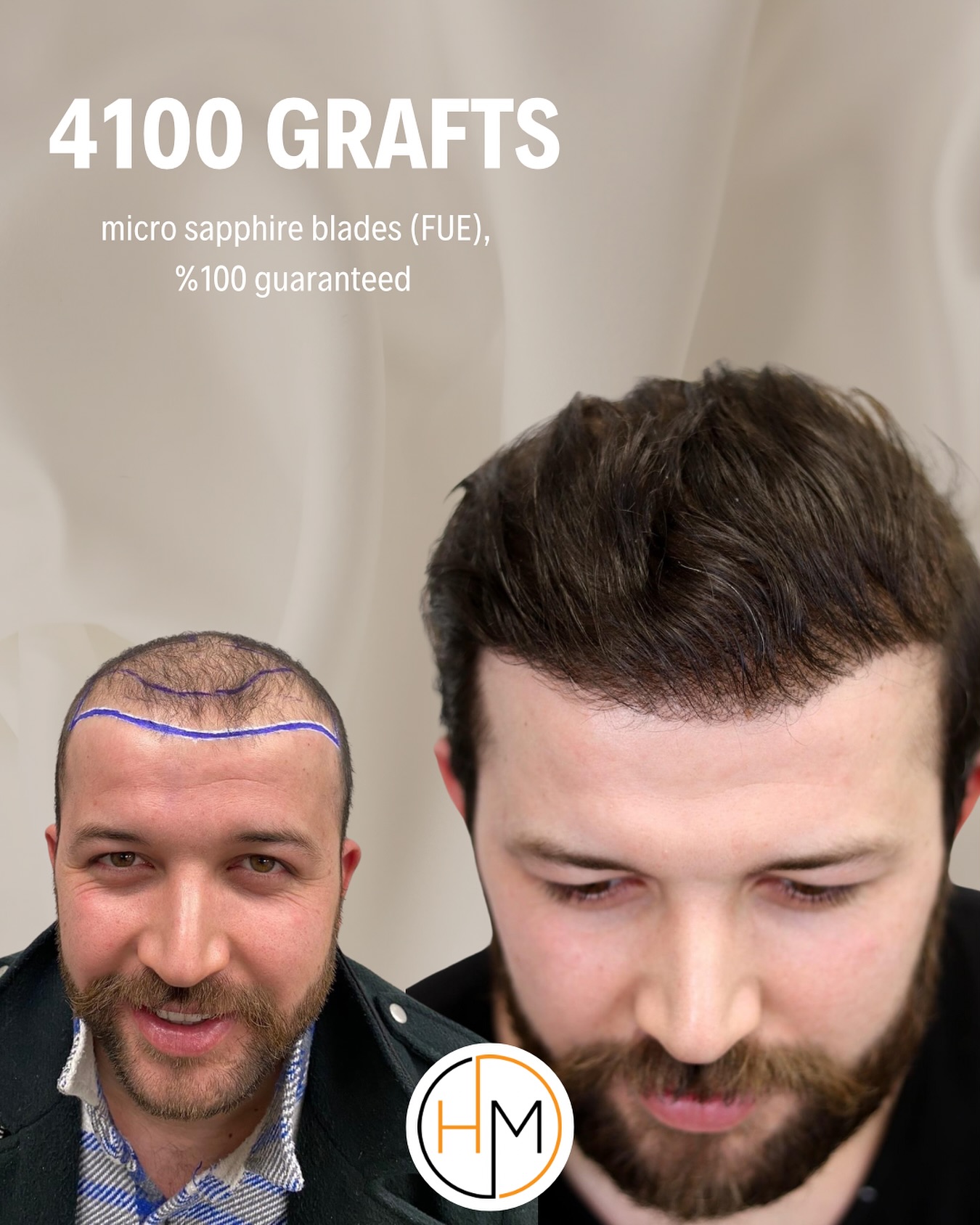 Hair Medica Saç Ekim Merkezi