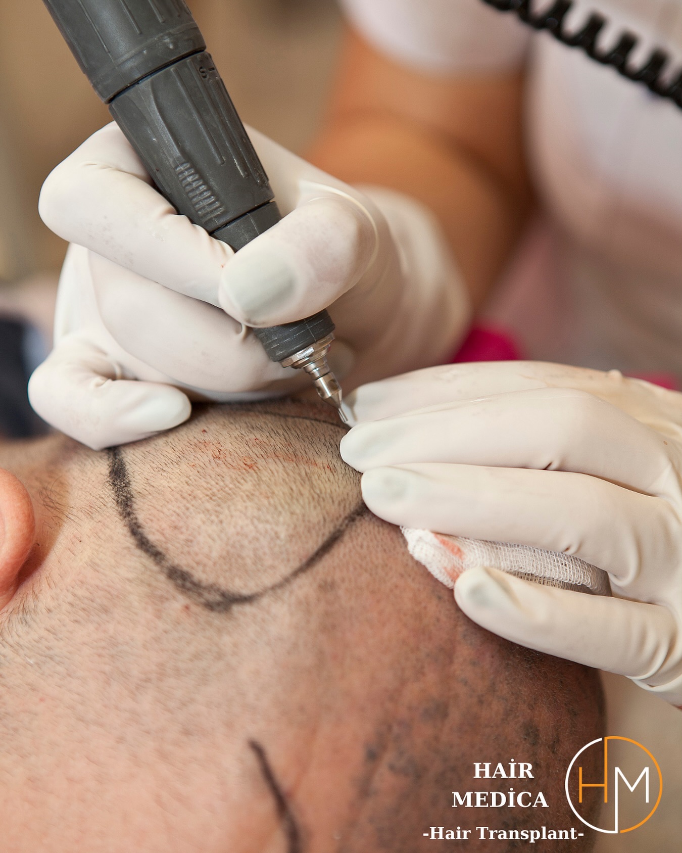 Hair Medica Saç Ekim Merkezi
