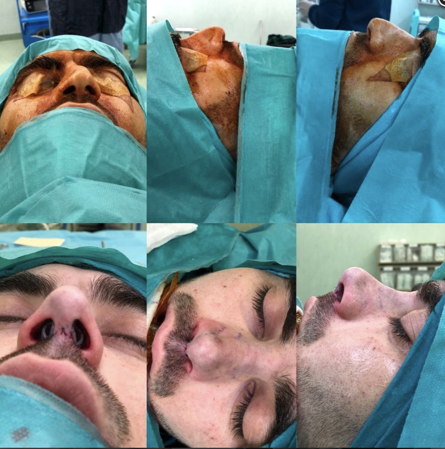 Prof.Dr. Arif Şanlı Kulak Burun Boğaz Cerrahisi