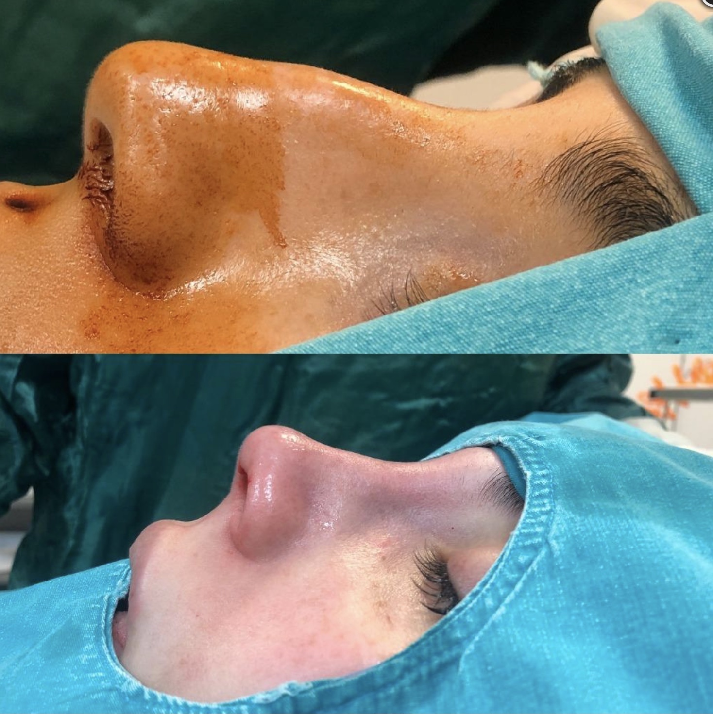 Prof.Dr. Arif Şanlı Kulak Burun Boğaz Cerrahisi